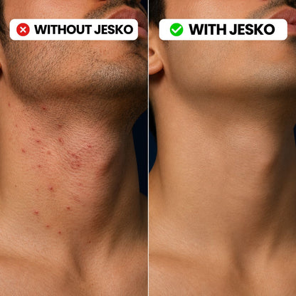 Jesko - SmoothCut Trimmer
